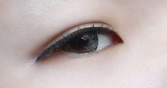 上海美莱水光针