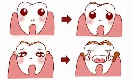 上海美莱医院做双眼皮整形手术