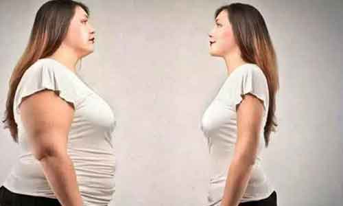 上海双眼皮手术案例