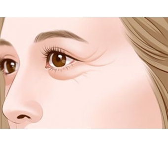 上海美莱皮秒祛斑