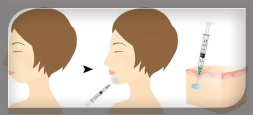 <a href='/' target='_blank'><u>上海美莱</u></a>面部吸脂拥有“上镜脸”