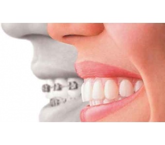 上海美莱仿真丝雾眉2180元起