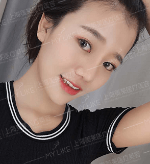 天生皮肤就黑怎么才能变白