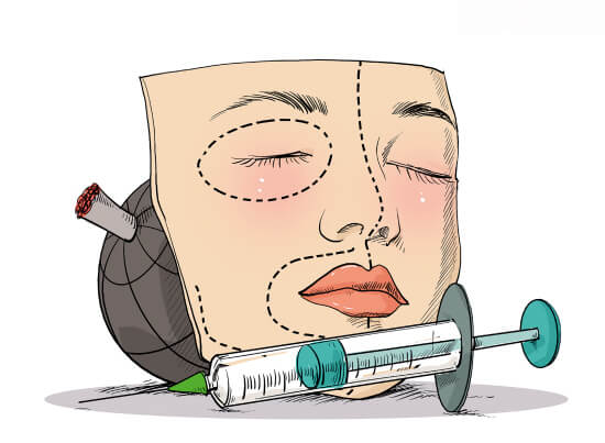 开眼角手术前后有哪些注意事项