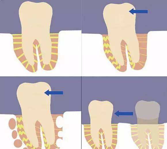 上海美莱万人脱毛节,全年包脱低至99元起
