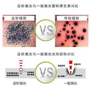 上海美莱眼部专家何祥龙