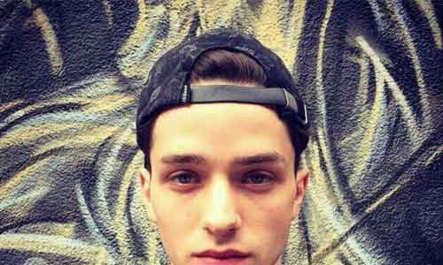 上睑下垂矫正后一般可以维持多久