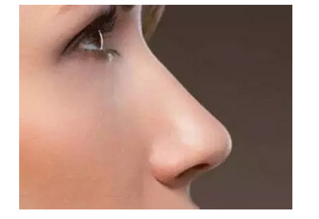 注射丰下巴多少钱