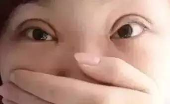 玻尿酸丰面颊效果好不好