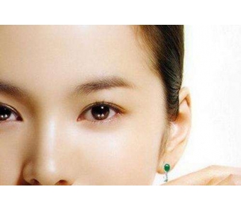 上海美莱双眼皮真人案例,打造属于你的美眼