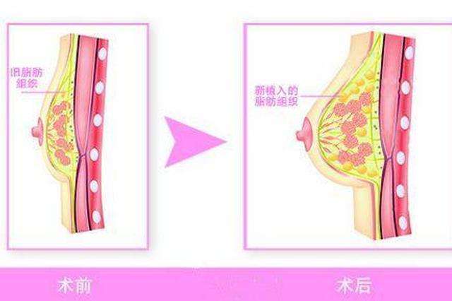 美莱女神节大礼包，让你秒变魅力女神