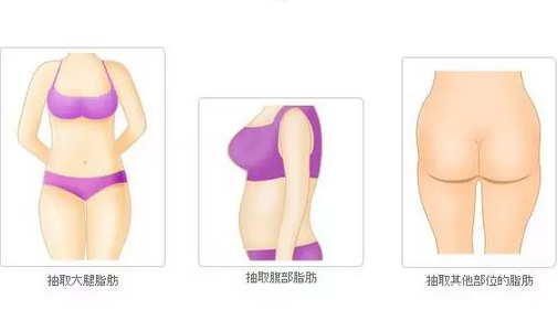 上海美莱3.8女神节,四大产品3.8折!