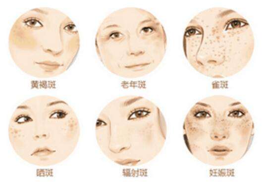 上海医院丰下巴一般需要多少钱