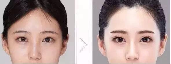 <a href='/' target='_blank'><u>上海美莱</u></a>玻尿酸只要688,一个变美的机会