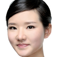 上海美莱医院自体脂肪面部填充