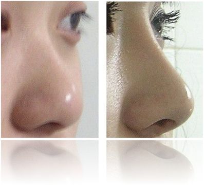 <a href='/' target='_blank'><u>上海美莱</u></a>激光脱毛