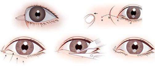 上海哪家纹美瞳线效果比较好