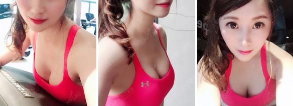 上海做漂唇哪家医院效果好