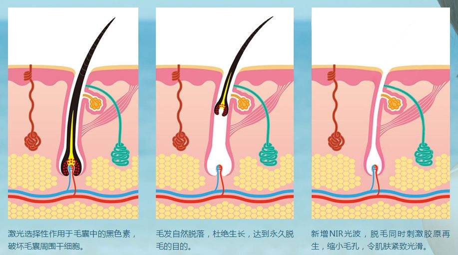 注射玻尿酸会不会有副作用啊?