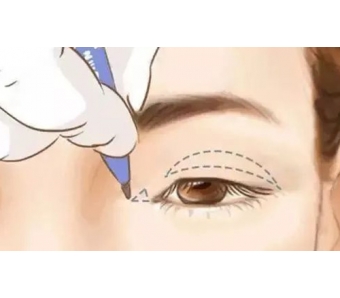 西安美莱医学美容院长夏炜