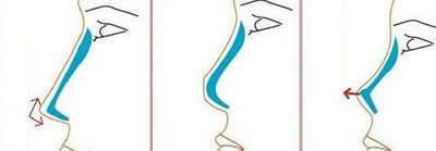 脱发严重怎么办,已经掉了很多头发了