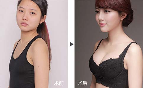 脱发严重怎么办,已经掉了很多头发了