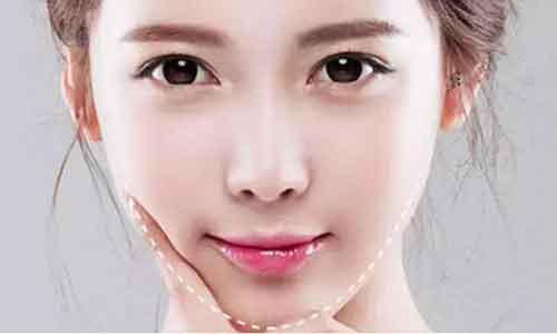 线雕埋线术真的可以除皱吗