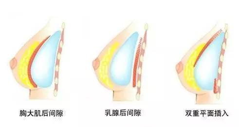 上海哪些人不适合纹眉