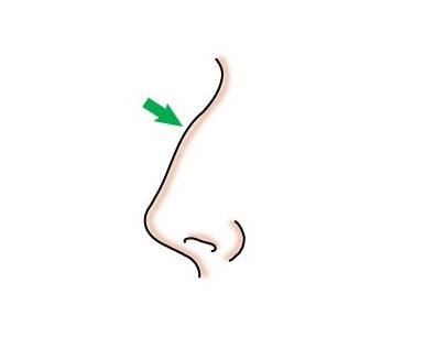 美莱集团眼整形技术总监杜医生