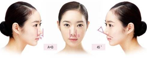 徐小程41岁/服装业女老板