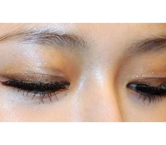 谭学敏28岁/唇腭裂、鼻畸形患者