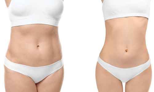 5个整形故事，美莱让你对整形放下偏见