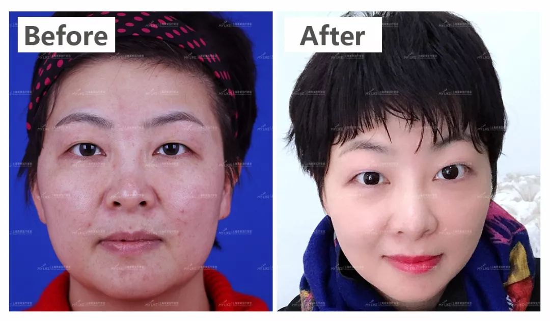 上海美莱半较久纹眉688元，先到先得