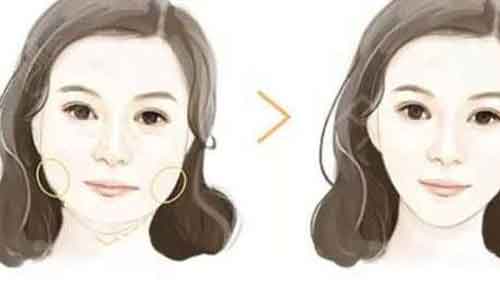 杨军教授医源性上睑下垂及眼睑退缩修复经验分享