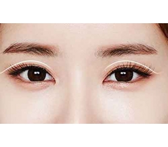 上海美莱注射丰唇