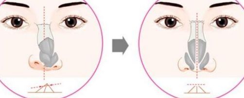 美莱“新宣颜”活动