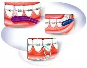 上海美莱申涛主任:关于玻尿酸注射的基础知识解析