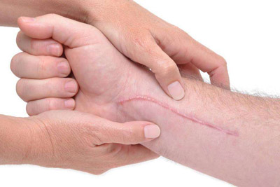 上海哪家医院激光脱毛效果比较好