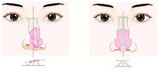 上海美莱举办杜医生教授"杜氏美眼"媒体见面会