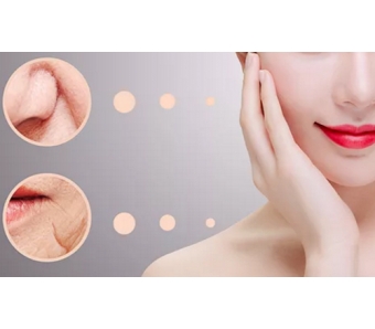 脸上的痘痘要怎么才能可以去掉