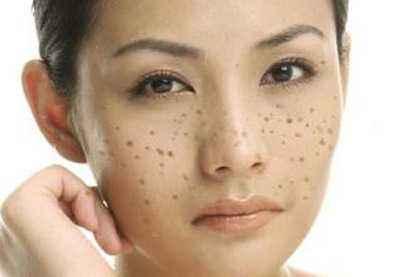 上海美莱杜医生倡导"健康眼整形"理念，各大媒体网站竞相报道