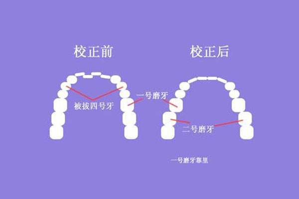 上海美莱医生做半较久纹眉,现在6折起