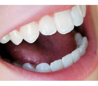 上海美莱启动一千万"鼻需整救"基金,达拉斯专家团加盟美莱