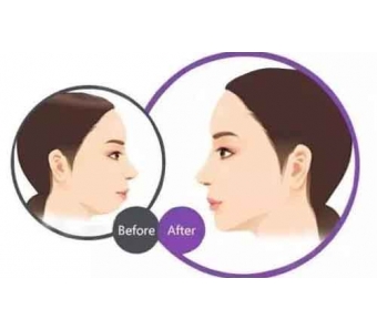 上海美莱启动一千万"鼻需整救"基金,达拉斯专家团加盟美莱