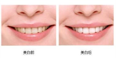 上海美莱艺术面雕节启动，打造标准的美人脸