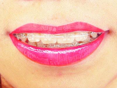 上海美莱艺术面雕节,6月整形钜优惠