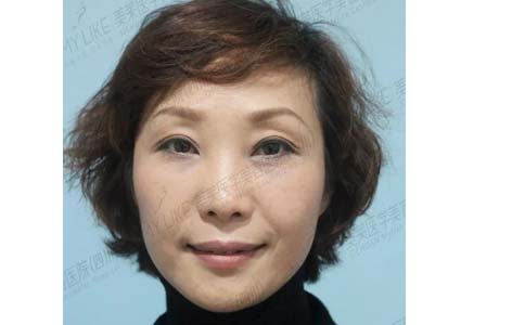 上海美莱艺术面雕节,6月整形钜优惠