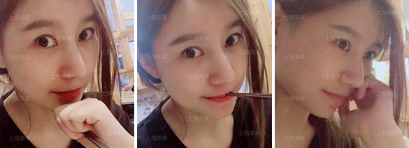 上海美莱杜医生、欧教授受邀参加第15届全国中西医结合医学美容大会