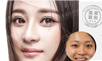 怎么瘦腿又快又有效