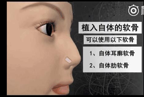 美莱携德宝俪共同开展中德乳房整形技术大会